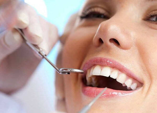 O Plano Dentário vale a pena? – Plano Odontológico DF